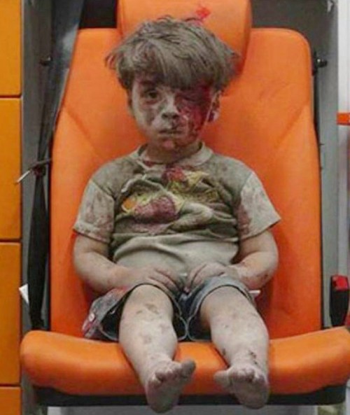 syrian child five Omran Daqneesh